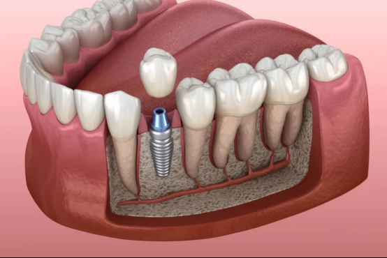 ea8123fe6b5a796f9c7a785847cef9c5.png ea8123fe6b5a796f9c7a785847cef9c5.png