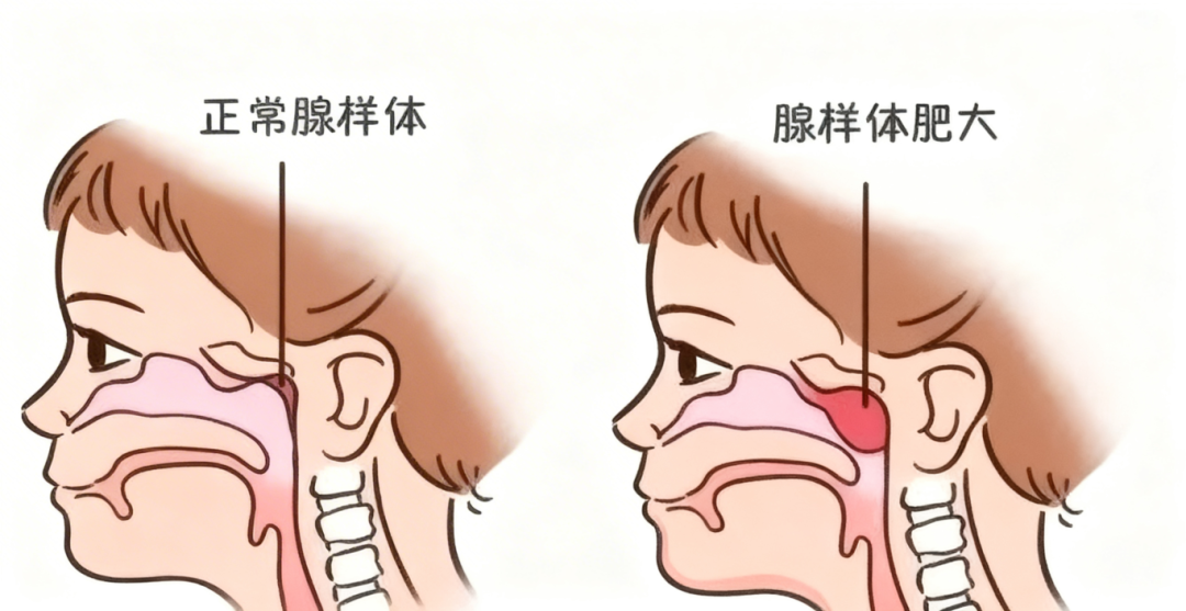 ce422ac5127dd689a0999a4067370252.png ce422ac5127dd689a0999a4067370252.png