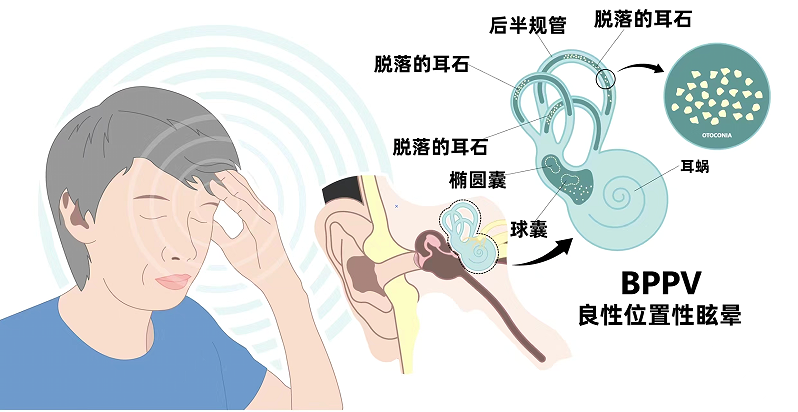 e250bb012f9d83948f2ee6380cae7b9a.png e250bb012f9d83948f2ee6380cae7b9a.png