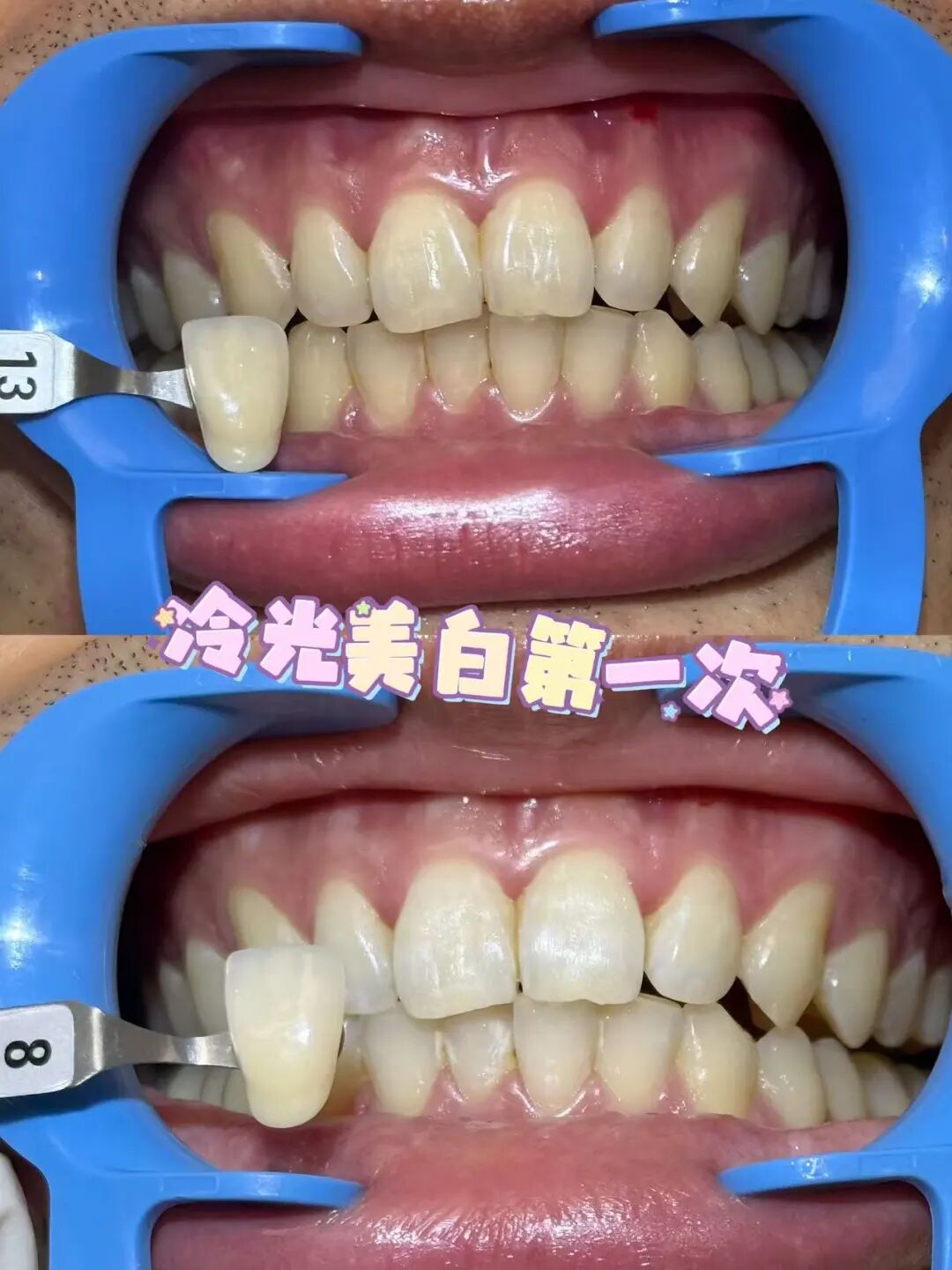 图片 图片