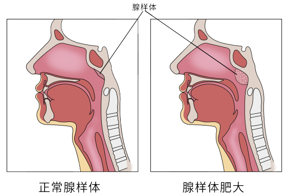 012b53bd1951b73a1de9d255a13b933e.png 012b53bd1951b73a1de9d255a13b933e.png